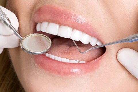 Почему чистка зубов ультразвуком - это идеальное решение